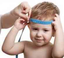 Hidrocefalusa u djece