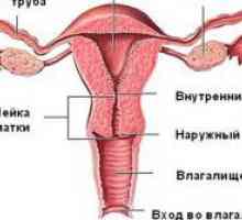 Krvarenje iz uterusa sa ugrušaka