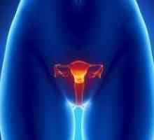 Maternice tumor - simptomi