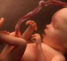 Pupčane vrpce u novorođenčadi