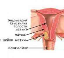 Rak grlića maternice - znakovi