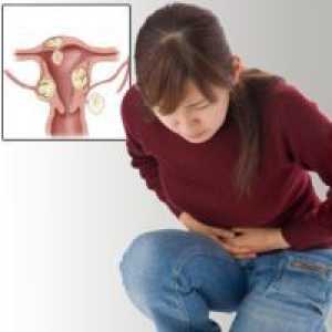 Tumor jajnika kod žena - tretman