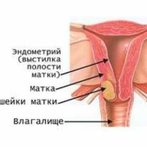 Rak grlića maternice - znakovi